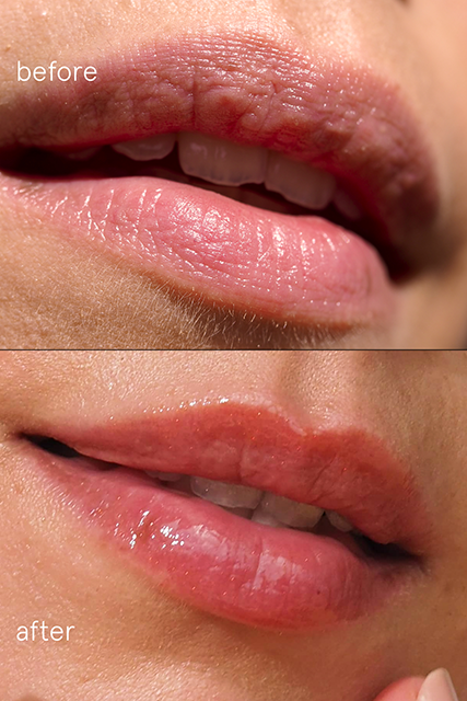 Nahaufnahme der Lippen: Vorher zeigt sich eine trockene, rissige Textur, nachher glatte, mit Feuchtigkeit versorgte Lippen, die mit einem Hauch von klarem Lip Glaze Nr. 04.