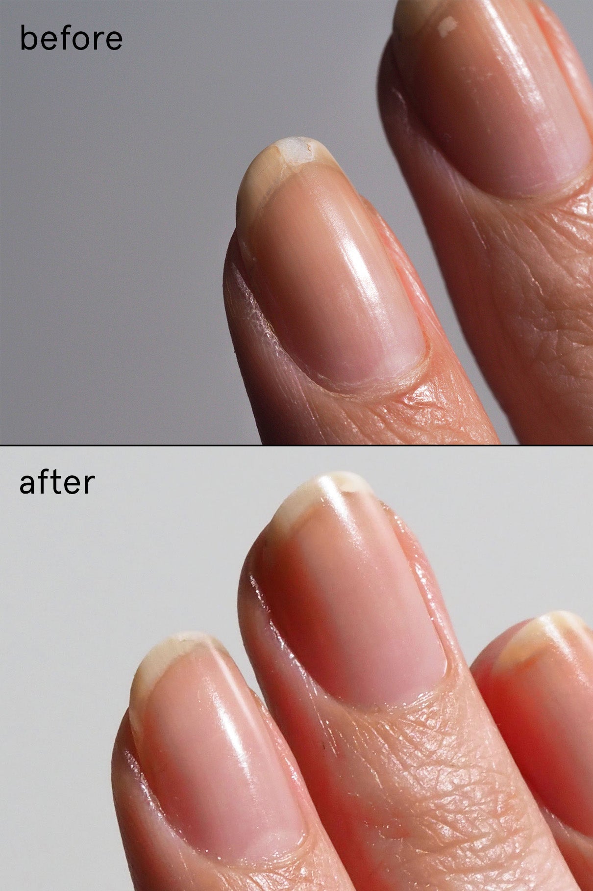 Nail Recovery Treatment, Nagelpflege Routine Vorher Nachher