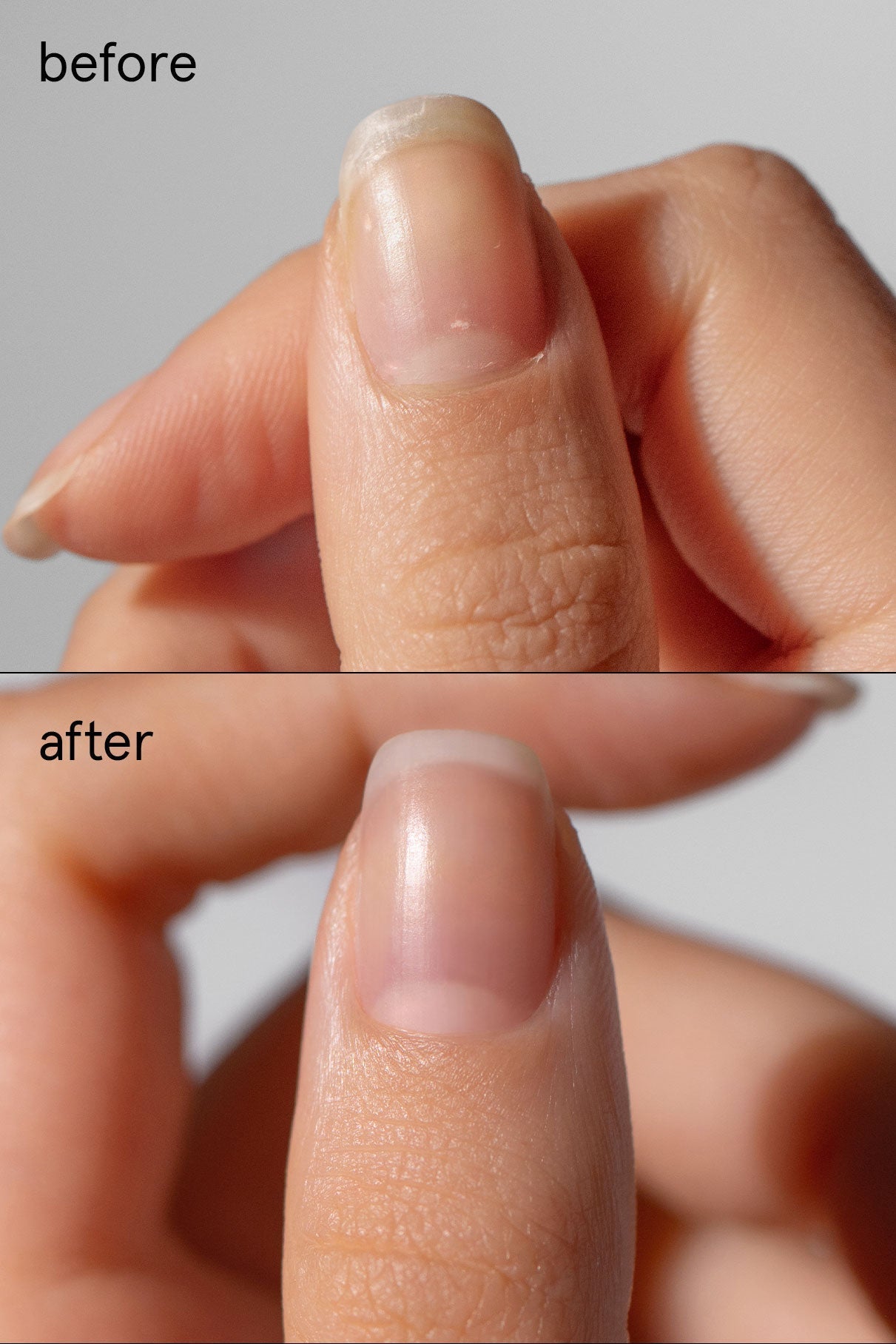Nahaufnahme eines Daumennagels im Vorher-Nachher-Vergleich, der die verbesserte Glätte und Gesundheit mit Hilfe von Nail Recovery Duo zeigt.